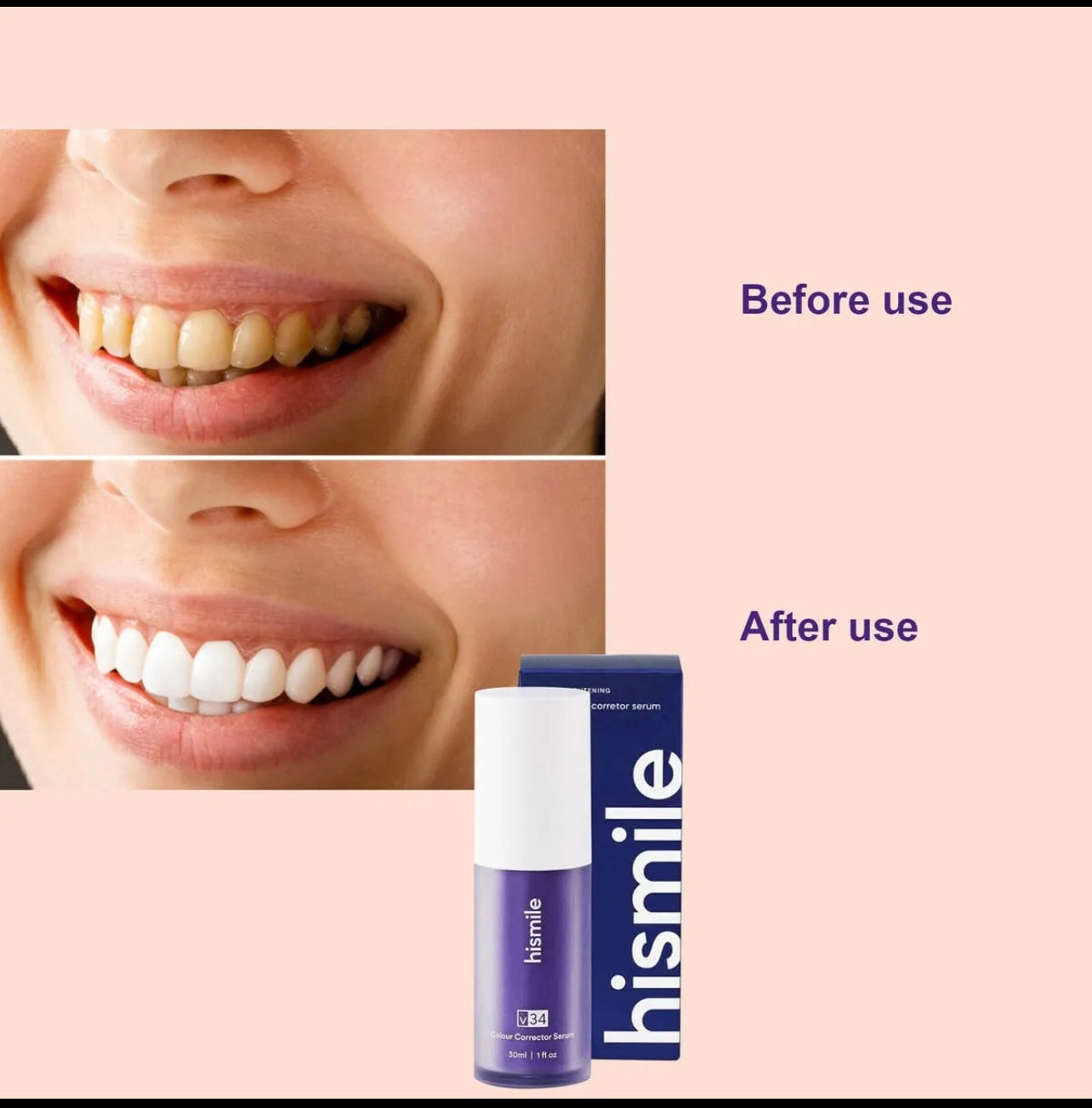 Hismile Teeth Whitening Purple Toothpaste