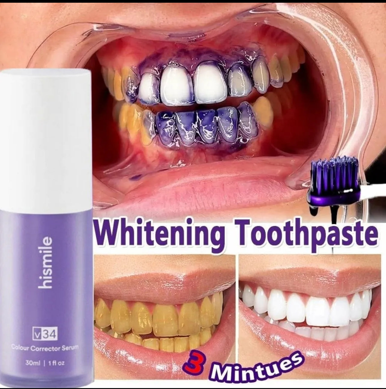Hismile Teeth Whitening Purple Toothpaste