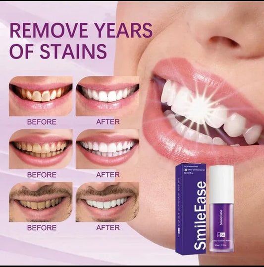 Hismile Teeth Whitening Purple Toothpaste